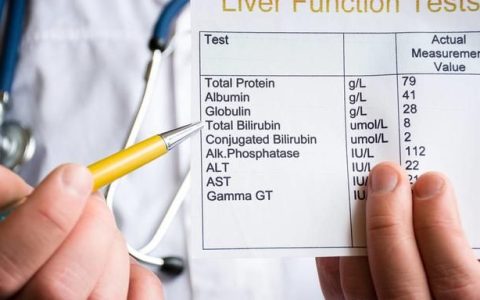 体检发现胆红素升高,就一定是肝病吗?