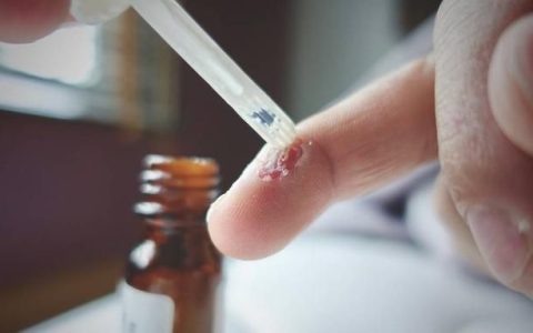 水杨酸的作用和危害(水杨酸和壬二酸使用方法)