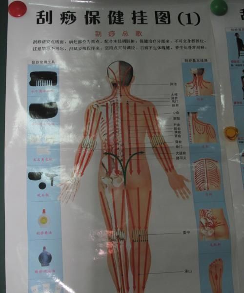 刮痧有什么好处吗(背刮痧有什么好处)图1