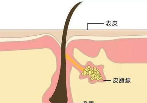 洗面奶有必要买多种功效的吗图6