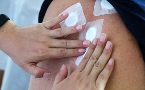 冬病夏治三伏贴的中药配方,入伏第一天夏治三伏贴