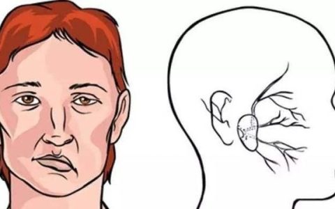 真有永久性除皱术吗知乎,现在最好的除皱手术