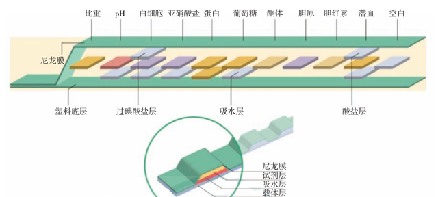 体检为什么总是尿隐血阳性？今天来说个明白