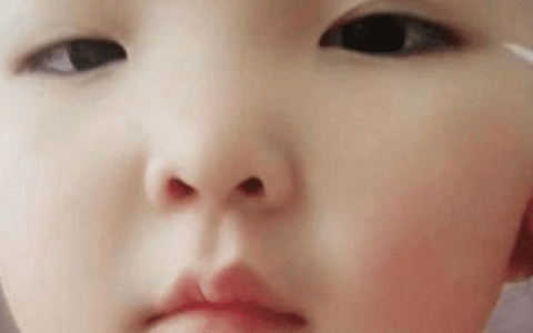 14岁开始整容,花费超四百万,脸上是一栋楼