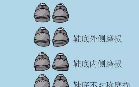 鞋底磨偏是什么原因,鞋底总是一边磨得低要不要看医生