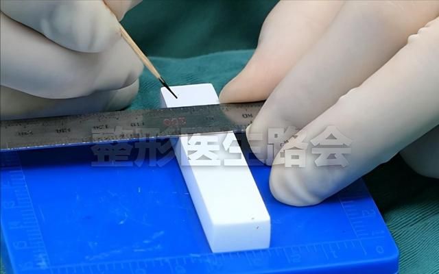 20岁姑娘不远万里来京隆鼻，7天获得自然妈生鼻，手术细节大公开