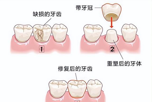 拔2颗牙花了1800，医生到底是为了治我的牙，还是为了抢我的钱？