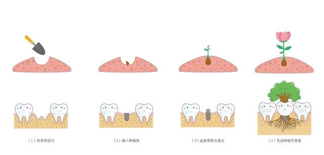 拔2颗牙花了1800，医生到底是为了治我的牙，还是为了抢我的钱？