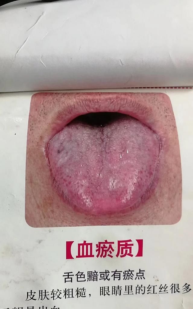 五谷杂粮要怎么吃才有养生的功效呢图6