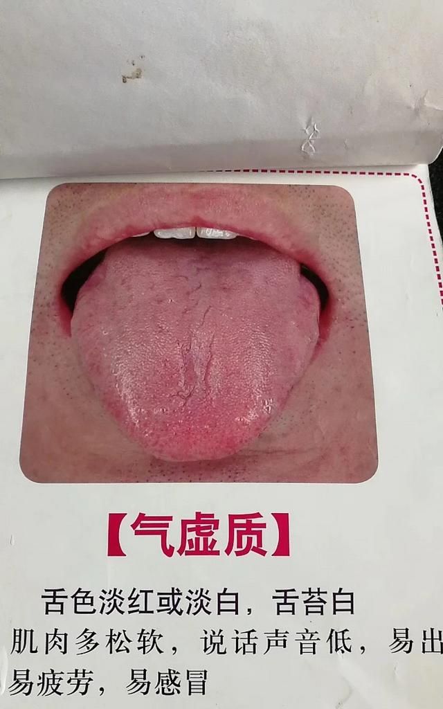 五谷杂粮要怎么吃才有养生的功效呢图9