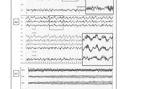 脑炎昏迷在重症监护室有哪些治疗