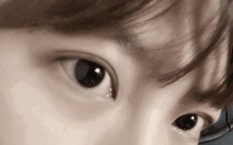 割个双眼皮手术大概要多少费用