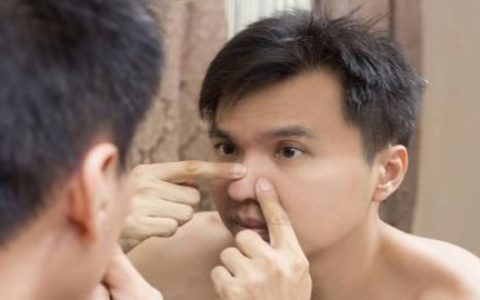 六种让男人祛痘不留印的方法是什么