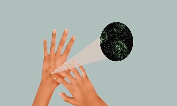 鱼腥草含“马兜铃酸”，损伤肾脏还致癌？到底能不能吃，和你说清