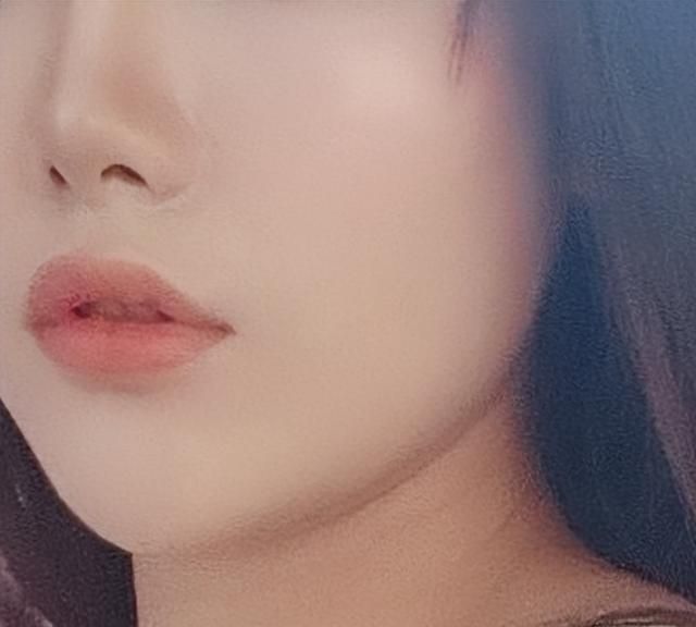脸上不小心挫伤了一块，不意外地留了疤，治疗后终于让我找回自信