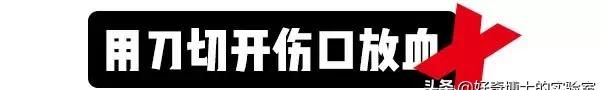 我一朋友被五步蛇咬了，现在已经走了四步，会死吗？#清风计划#