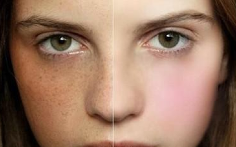 4分钟带你了解斑