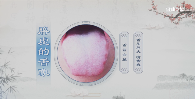 中医教您如何对症下药调脾胃，药食同补赶紧收藏起来！