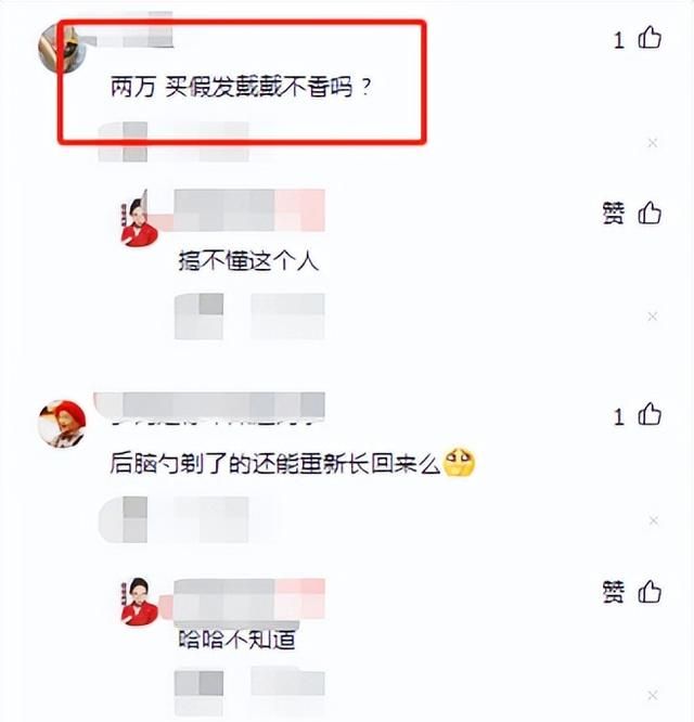 喜剧人娇娇花2W植发，后脑勺剃成长方形，网友：买假发戴不香吗？