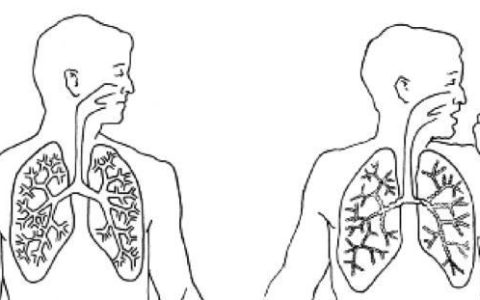 突然咳嗽胸闷气短呼吸困难是过敏吗