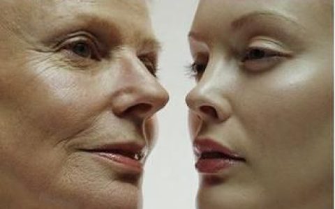 额头提拉除皱整形效果,安多泰额头除皱