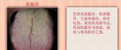 中医体质之湿热型体质（二）
