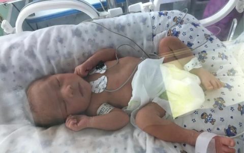 单绒单羊双胎孩子好吗,单绒双羊胎宝宝发育过程