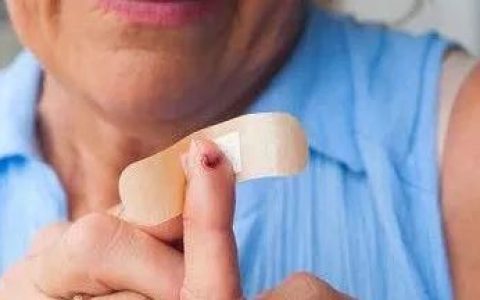 创可贴不万能,只能应付这一种伤口吗