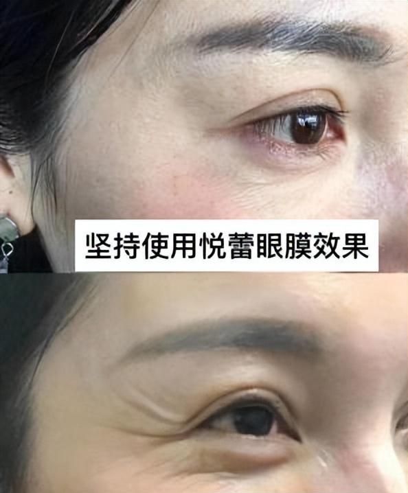 眼部护理常识：去除眼睛下皱纹清洁及抗皱会至关重要