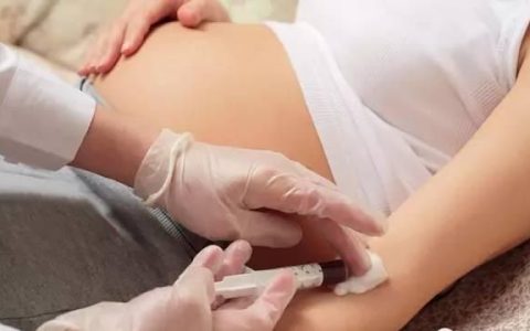 孕妇查出单纯孢疹病毒抗体阳性必须要引产吗