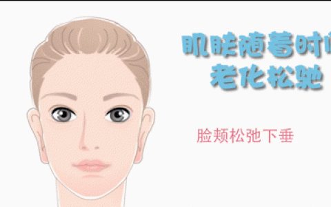内窥镜微创面部提升(微创面部提升除皱术)