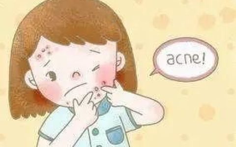 挤面部三角区痘痘导致脸肿(痘痘两三年没有大面积扩散)