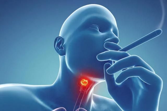 咽喉炎有哪些表现？