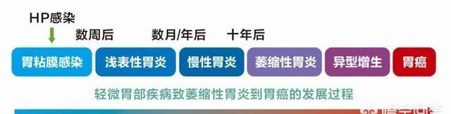 有什么药可以治疗幽门螺旋杆菌的图5
