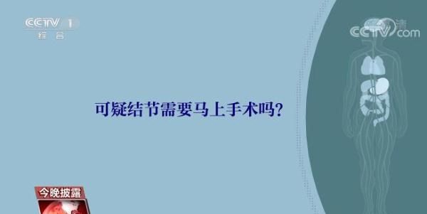 体检查出肺结节怎么办？保护肺部健康应该做些什么？一文解答