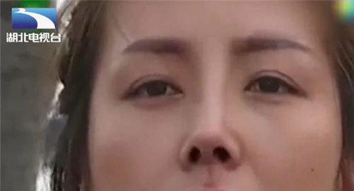 女子花3万整形，鼻子歪了鼻孔一大一小，老公：人不像人鬼不像鬼