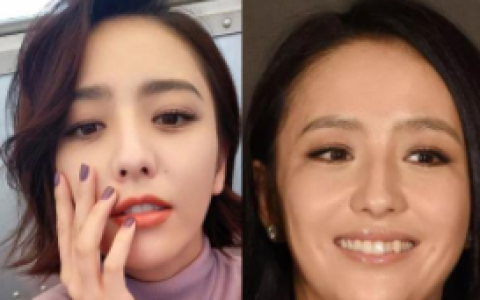 面部吸脂下巴凹凸不平能恢复么