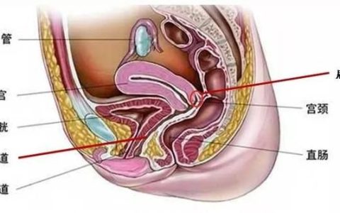 不完全女性是什么意思,阴道用硝呋太尔说明书