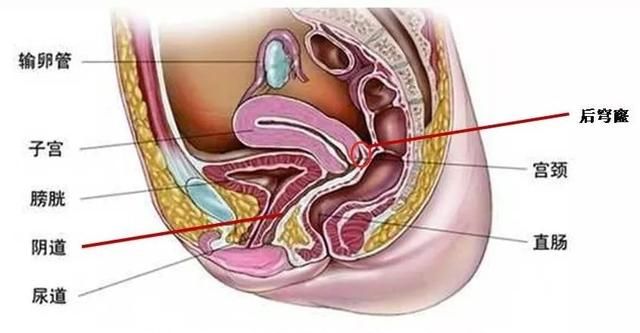 阴道的不完全说明书