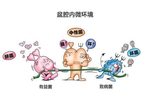 盆腔炎注意哪些事项(盆腔炎男方注意什么)图6