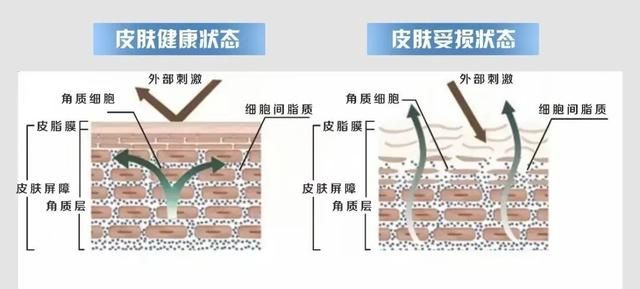 干、痒、红，皮肤敏感怎么办？三步教你哄好敏感肌！
