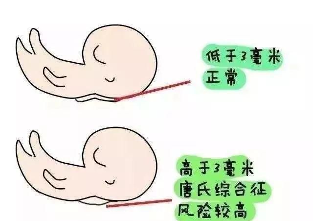 怀孕唐筛和无创羊穿做哪个比较好图2