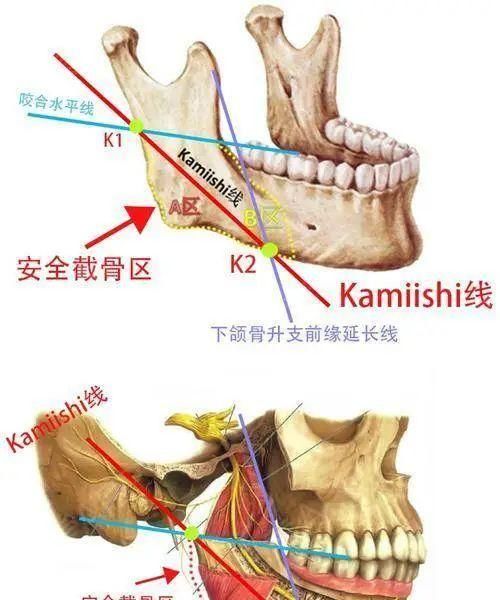 如何安全地截出漂亮的下颌线？