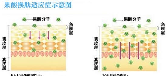 果酸的正确使用方法,修丽可果酸的使用方法图2
