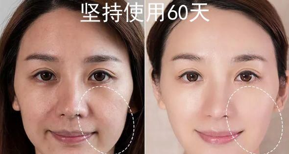 风靡日本的磁石耳环，提拉紧致轻松get，脸瘦了、下巴尖了