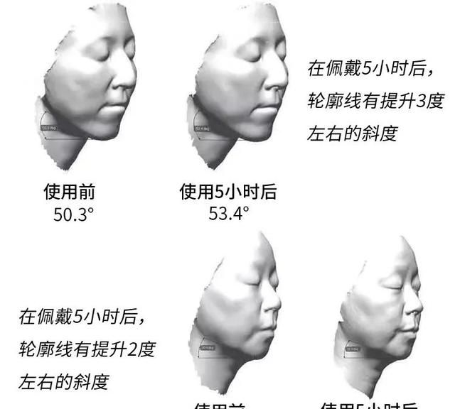 风靡日本的磁石耳环，提拉紧致轻松get，脸瘦了、下巴尖了