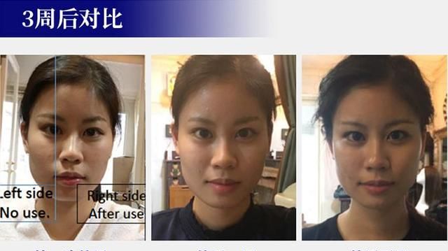 风靡日本的磁石耳环，提拉紧致轻松get，脸瘦了、下巴尖了