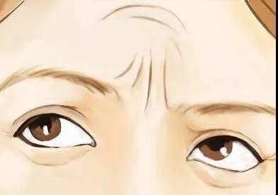 针对眉间去皱纹，分享一个非常简单的去皱纹方法