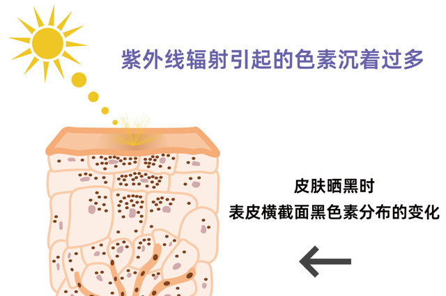 顽固的雀斑、痘印、黄褐斑……竟都靠这招能解决？