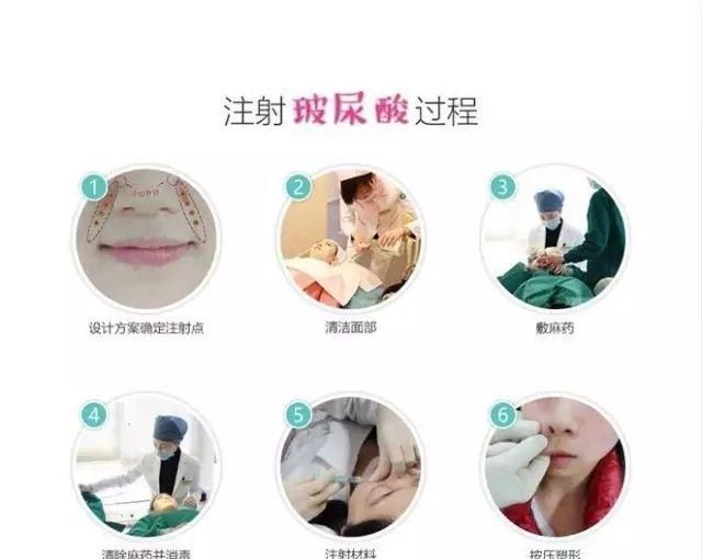 玻尿酸有什么用处图3